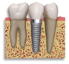 Phoenicia - clinica stomatologica